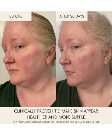 Shop MARA Niacinamide + Copper Clear Skin Mineral Milk Acne Treatment - 30mL - 1 oz / 30 mL Online - Best Price & International Shipping - Buy Online on GoSupps.com