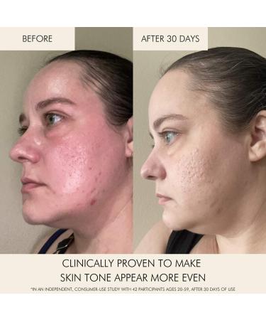 Shop MARA Niacinamide + Copper Clear Skin Mineral Milk Acne Treatment - 30mL - 1 oz / 30 mL Online - Best Price & International Shipping - Buy Online on GoSupps.com