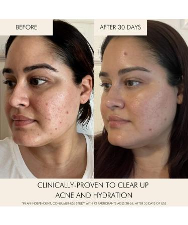 Shop MARA Niacinamide + Copper Clear Skin Mineral Milk Acne Treatment - 30mL - 1 oz / 30 mL Online - Best Price & International Shipping - Buy Online on GoSupps.com