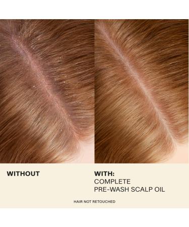 Shop JVN Complete Pre-Wash Scalp & Hair Strengthening Treatment Oil - 1.7 oz/ 50 ml Online - Best Price & International Shipping - Buy Online on GoSupps.com