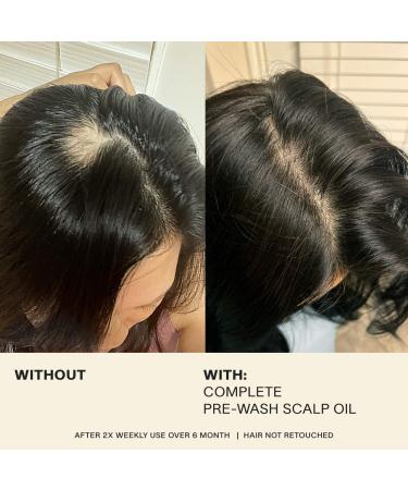Shop JVN Complete Pre-Wash Scalp & Hair Strengthening Treatment Oil - 1.7 oz/ 50 ml Online - Best Price & International Shipping - Buy Online on GoSupps.com