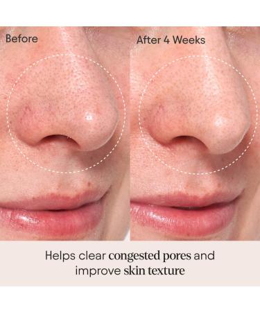 Shop Alpyn Beauty Clarifying Facial Oil with Retinol & Pink Algae - 1 oz / 30 ml Online - Best Price & International Shipping - Buy Online on GoSupps.com