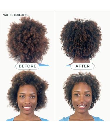 Shop Sienna Naturals Daily Elixir Scalp Treatment Oil - 3 oz Online - Best Price & International Shipping - Buy Online on GoSupps.com