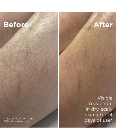 Shop ISDIN Uradin Lotion 10 Hydrating Body Lotion for Dry Skin - 13.5 oz / 400 ml Online - Best Price & International Shipping - Buy Online on GoSupps.com