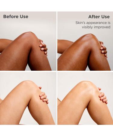 Shop ISDIN Uradin Lotion 10 Hydrating Body Lotion for Dry Skin - 13.5 oz / 400 ml Online - Best Price & International Shipping - Buy Online on GoSupps.com