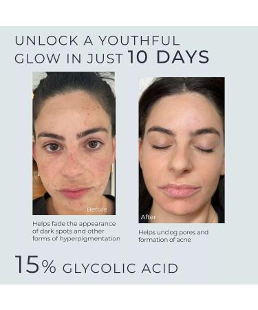 Instaskincare lycolic Acid Serum for Face 15% - 2Oz - Buy Online on GoSupps.com