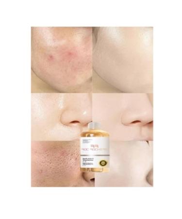 roc rochers Skin Whitening & Tone Lightening & Brightening Face Toner Anti-Aging Acne Remover - Buy Online on GoSupps.com