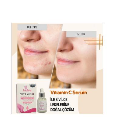 Vawix Vitamin C Serum Anti-Dark Spots and Wrinkles