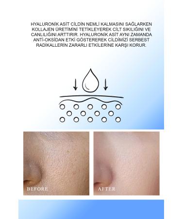 QUEEN CHARM Intensive Moisturizing Bio Triple Hyaluronic Moisture Serum - Buy Online on GoSupps.com