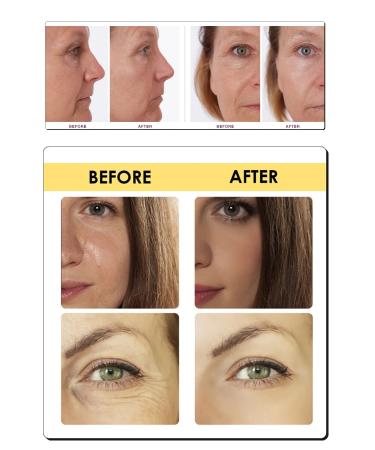 Puredermine CONCENTRATED CENTELLA ASIATICA & HYALURONIC ACID & PEPTIDE & B5 & COMPLEX SERUM & RETURN GUARANTEED - Buy Online on GoSupps.com