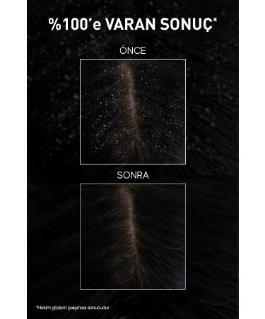 Bioxcin Aqua Thermal Anti-Dandruff Shampoo 300 Ml SET OF 3 - Buy Online on GoSupps.com