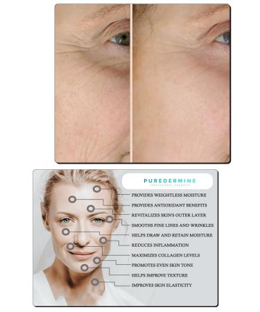 Puredermine CONCENTRATED CENTELLA ASIATICA & HYALURONIC ACID & PEPTIDE & B5 & COMPLEX SERUM & RETURN GUARANTEED - Buy Online on GoSupps.com