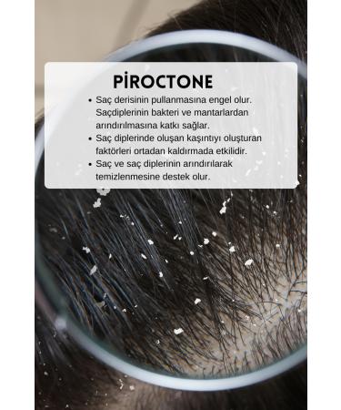 wiosen Complete Care Against Hair Loss Anti-Dandruff Repairing Shampoo 400 ml - Buy Online on GoSupps.com