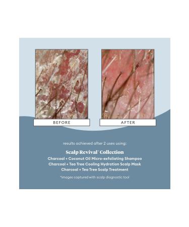 briogeo Scalp Revival Charcoal - Purifying Shampoo (226ml) - Buy Online on GoSupps.com