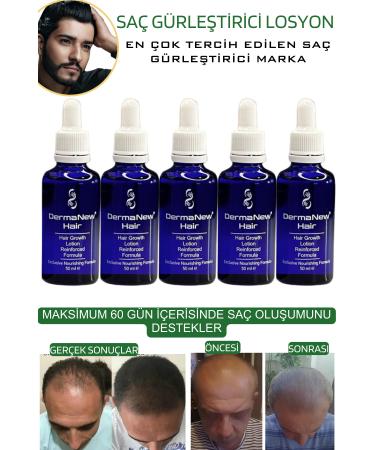 dermanew hair Hair Natural Solution / 5 Serums