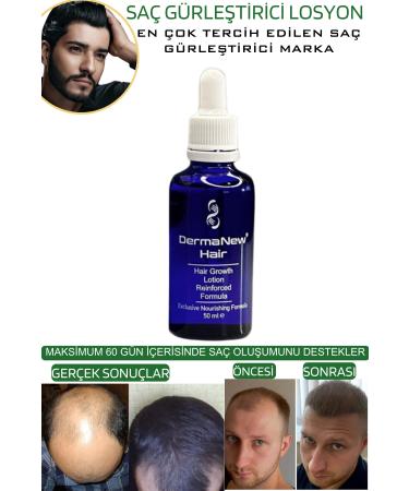 dermanew hair Hair Thickening Serum - Anti-Loss Shampoo Roller Gift / 5x50ml - Buy Online on GoSupps.com