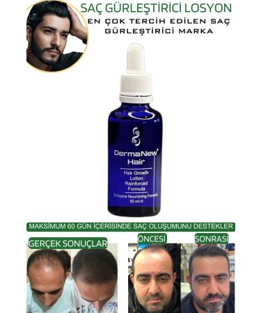 dermanew hair Hair Natural Solution / 5 Serums - Buy Online on GoSupps.com