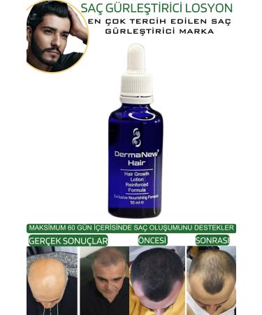 dermanew hair Hair Thickening Serum - Anti-Loss Shampoo Roller Gift / 5x50ml - Buy Online on GoSupps.com