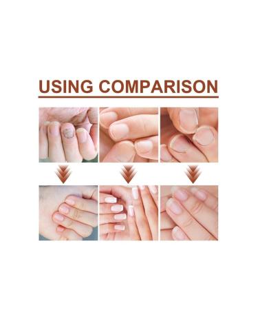 roc rochers Effective Herbal Content & Nail Mycosis Solution Toenail Fungus Treatment Repair - Buy Online on GoSupps.com