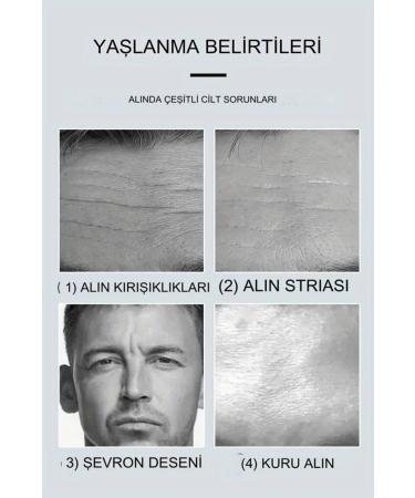 Xolo Forehead and Eyebrow Area Collagen Mask T Mask Open Area Abundant Collagen Support Mask XLM9117 - Buy Online on GoSupps.com