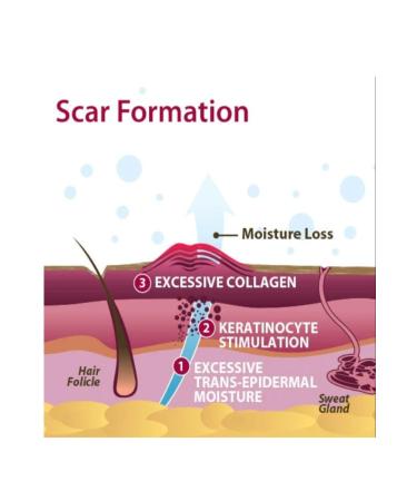 XERAGEL SCAR REMOVER SILICONE GEL CREAM 10G - Buy Online on GoSupps.com