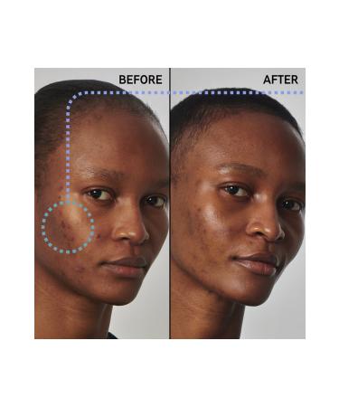 THE INKEY LIST Balancing-Pore Tightening Face Serum for Oily Skin 30 ml Ko ak446 - Buy Online on GoSupps.com