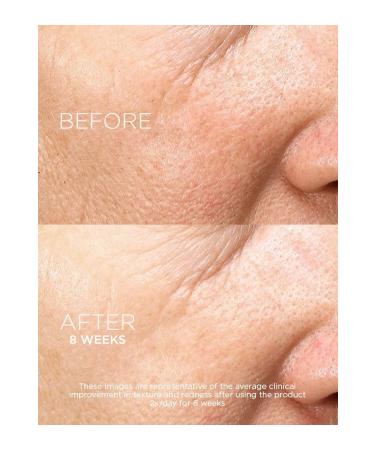 Darphin Intral Inner Youth Rescue-Anti-Aging and Anti-Redness Moisturizing Brightening Serum 15ml - Buy Online on GoSupps.com