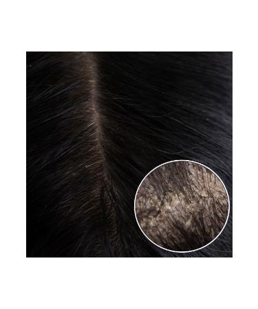 Duru Garlic & Biotin & Collagen Anti-Hair Loss Shampoo 3x700 ml - Buy Online on GoSupps.com