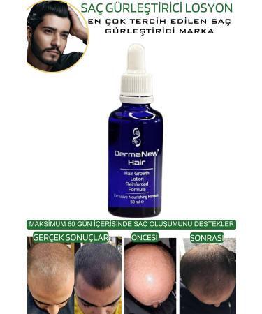 dermanew hair hair serum hair care oil3 Pieces Serum + Roller + Shampoo - Buy Online on GoSupps.com