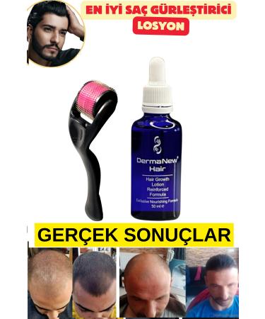 dermanew hair Hair thickener - hair care set - hair care - hair serum - hair serum and oil - hair / 1 Piece + Roller