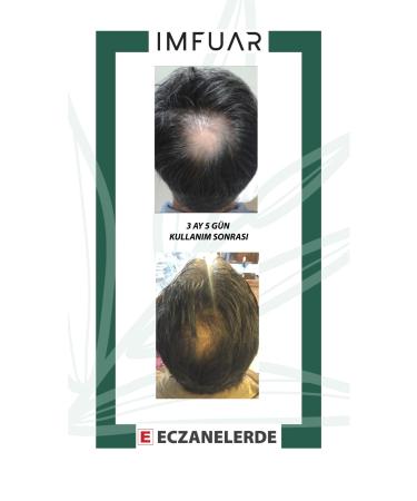 IMFUAR Supports New Hair Formation Prevents Hair Loss Hair Serum 50 Ml 63 Different Active Ingredients - Buy Online on GoSupps.com