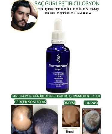 dermanew hair Hair Care Set - Hair Care Hair Serum and Oil - Hair / 1 Piece Roller - Buy Online on GoSupps.com