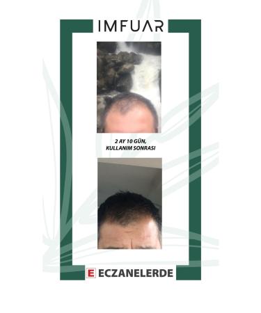 IMFUAR Supports New Hair Formation Prevents Hair Loss Hair Serum 50 Ml 63 Different Active Ingredients - Buy Online on GoSupps.com