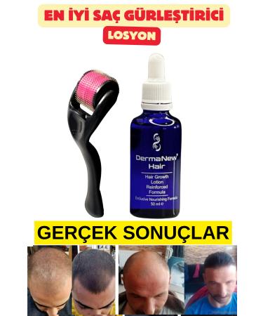 dermanew hair Hair Care Set - Hair Care Hair Serum and Oil - Hair / 1 Piece Roller