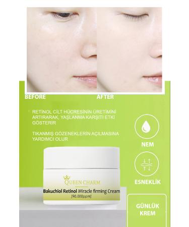 QUEEN CHARM Firming Concentrate Bachuchiol Miracle Firming Retinol Cream - Buy Online on GoSupps.com
