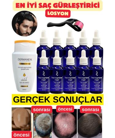 Dermanew Hair Hair Care Set Hair Serum 10 Pieces + Roller + Shampoo