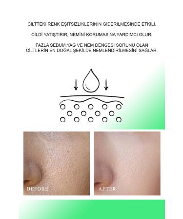 QUEEN CHARM GreenTea Centella Cica Premium Serum for Acne-Prone Skin - Buy Online on GoSupps.com