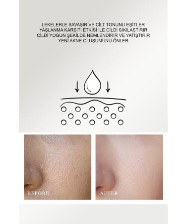 QUEEN CHARM Niacinamide Premium Serum for Blemish Prone Skin - Buy Online on GoSupps.com