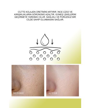 QUEEN CHARM Firming Bachuchiol Miracle Firming Retinol Serum - Buy Online on GoSupps.com
