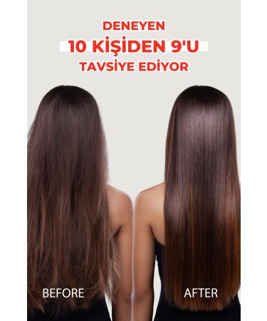 Zigavus Forte Anti Hair Loss Shampoo 300 ml - Dry and Normal Hair - Buy 3 Pay 2 8699349130961 - Buy Online on GoSupps.com