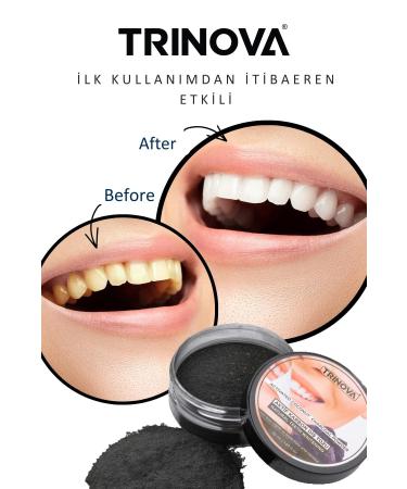 Trinova Teeth Whitening Powder Activated Carbon Teeth Cleaning Powder - Buy Online on GoSupps.com
