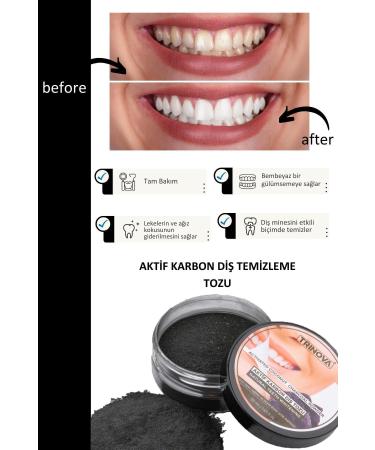 Trinova Teeth Whitening Powder Activated Carbon Teeth Cleaning Powder - Buy Online on GoSupps.com