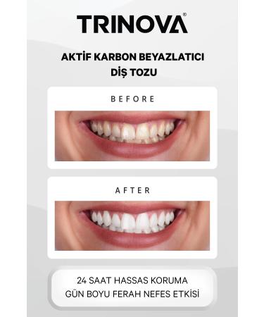 Trinova Teeth Whitening Powder Activated Carbon Teeth Cleaning Powder - Buy Online on GoSupps.com