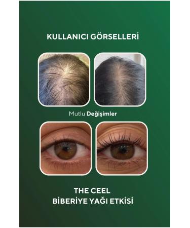 The Ceel 2-Piece Rosemary Oil Hair Care with Biotin Essence for Hair Loss and Extremely Damaged Hair 50 ml - Buy Online on GoSupps.com