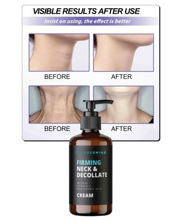 Puredermine Chin & Neck Firming Cream Firming & Chin Reducing Neck & Chest Care