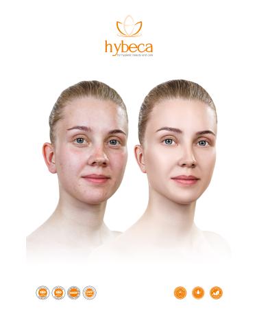 Hybeca Skin Tone Equalizer Anti-Spot Cream 50 ml - Buy Online on GoSupps.com