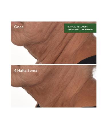 Murad RETINAL RESCULPT OVERNIGHT TREATMENT - RENEWING REPAIRING NIGHT SERUM CONTAINING RETINAL KEYON47 - Buy Online on GoSupps.com