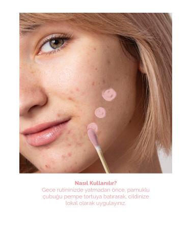 FaceLab Acne Drying Lotion - Acne Drying Lotion Acne Dryer - Buy Online on GoSupps.com