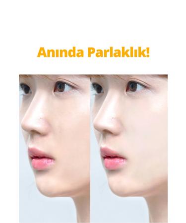 FRANKLY 5% Niacinamide Skin Tone Equalizer Brightener and Anti-Spot Sunday Glow Serum 37ml - Buy Online on GoSupps.com