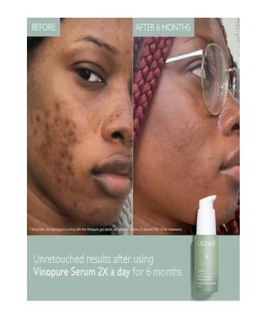 Caudalie VINOPURE SR Serum 30ML - Buy Online on GoSupps.com
